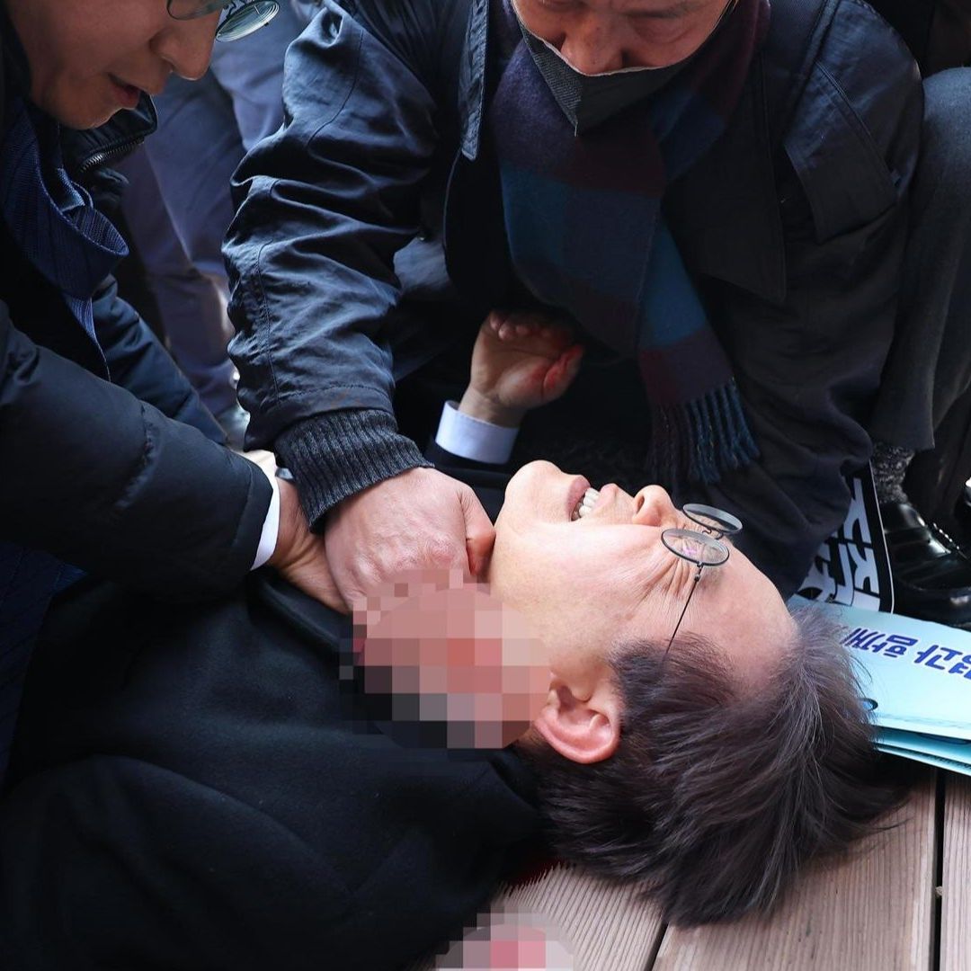 Al parecer Lee Jae-Myung está fuera de peligro. Foto: EFE