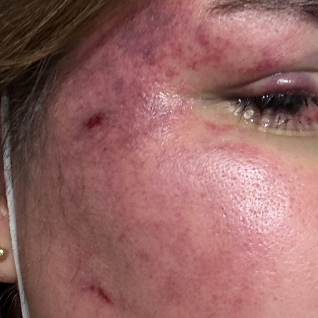 Mexicana Agredida en Colombia Pide Ayuda a la SRE