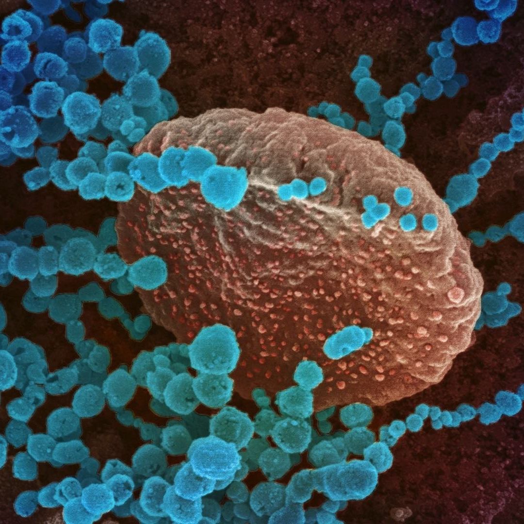 En azul varios virus rodean una célula humana
