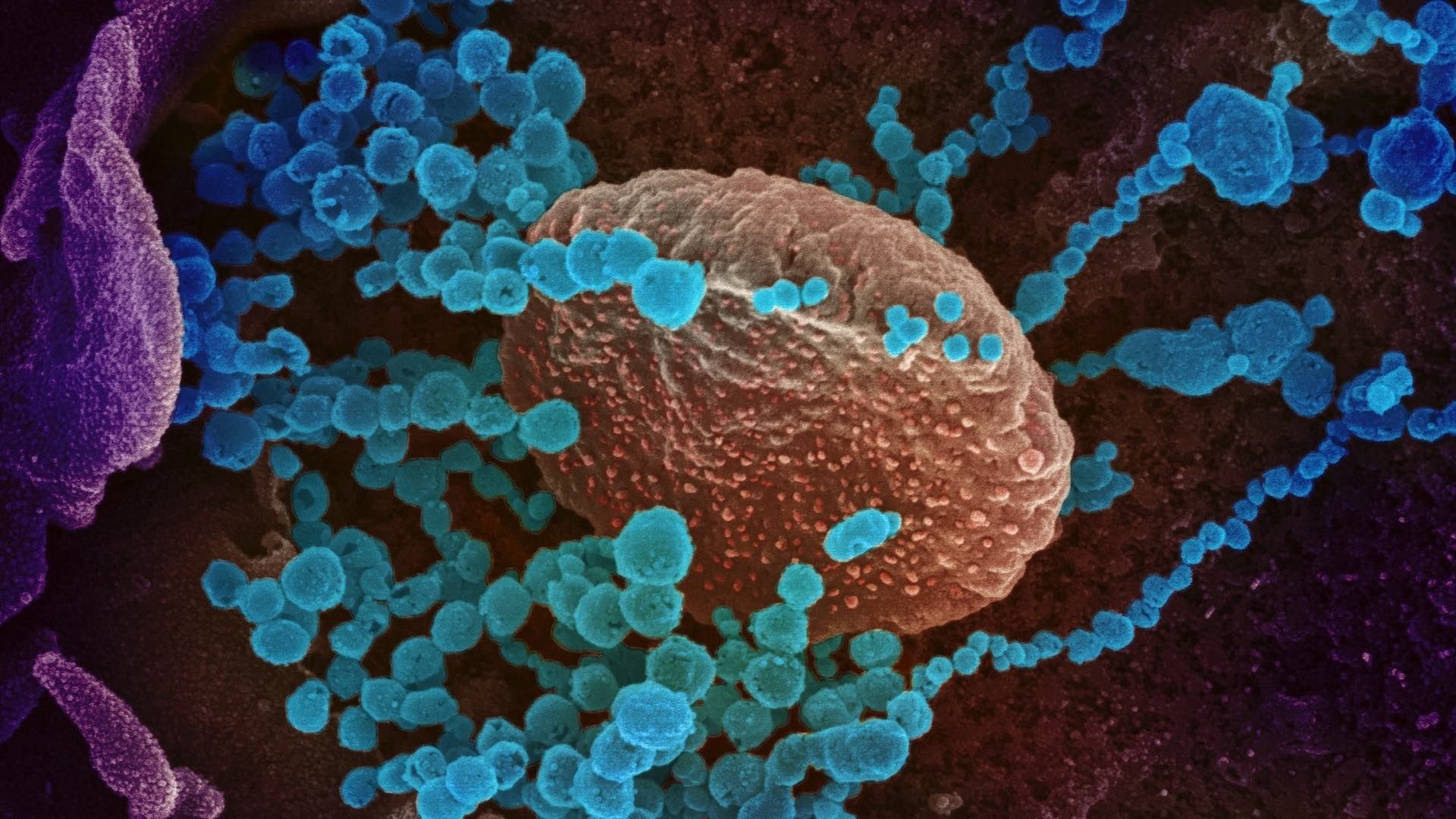 En azul varios virus rodean una célula humana