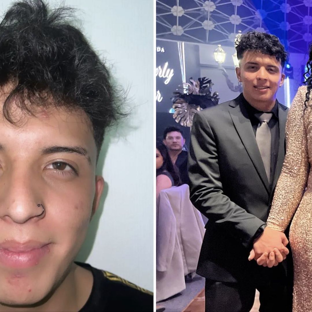 Novio de Paola Suárez aparece con la mano hinchada en video