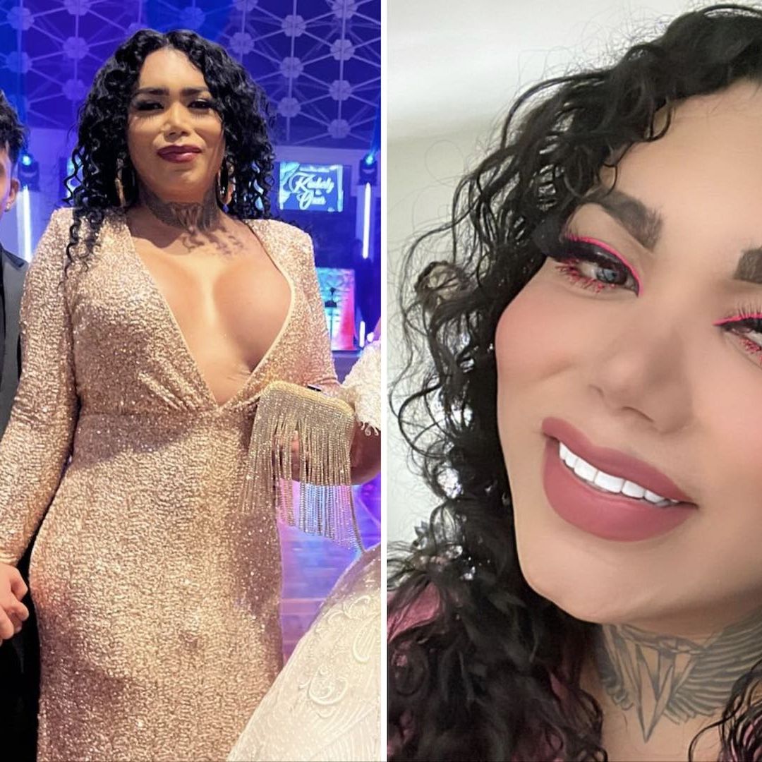Paola Suárez no perderá el ojo, según confirma Evelyn Hernández