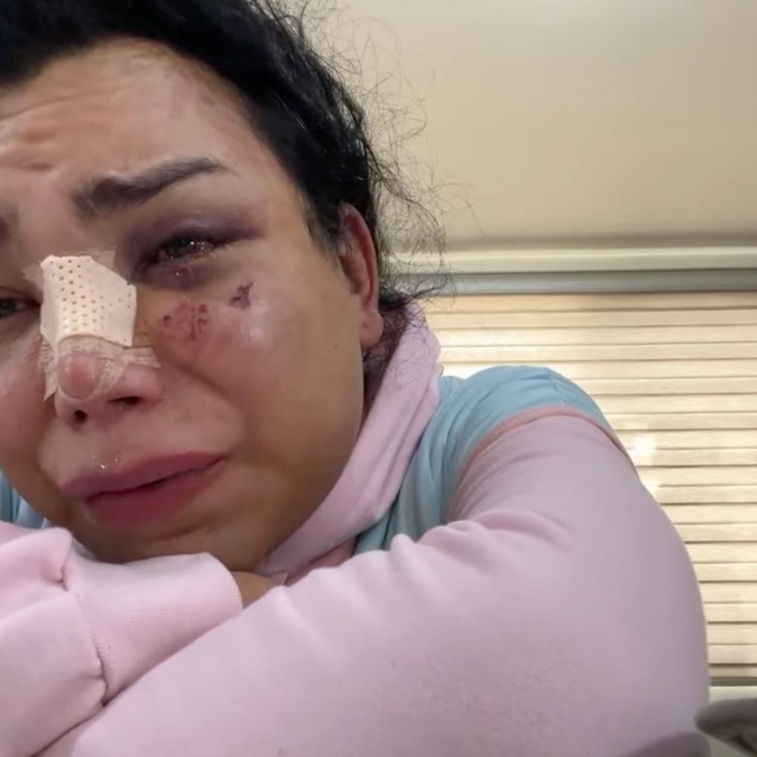 Paola Suárez es dada de alta tras agresión física