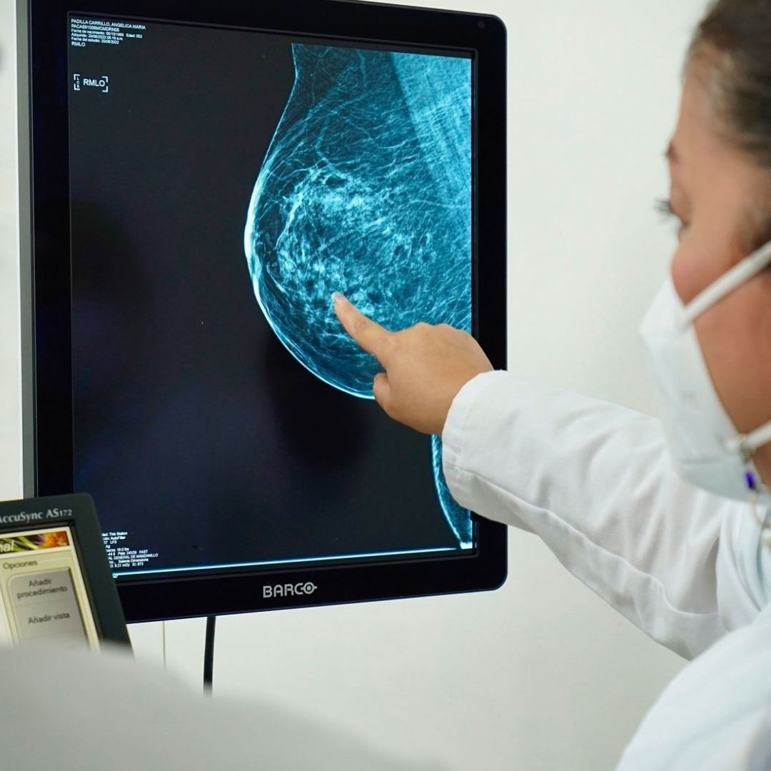 ¿Cuál Es la Principal Causa de Muerte por Cáncer entre Mujeres y Hombres en México?