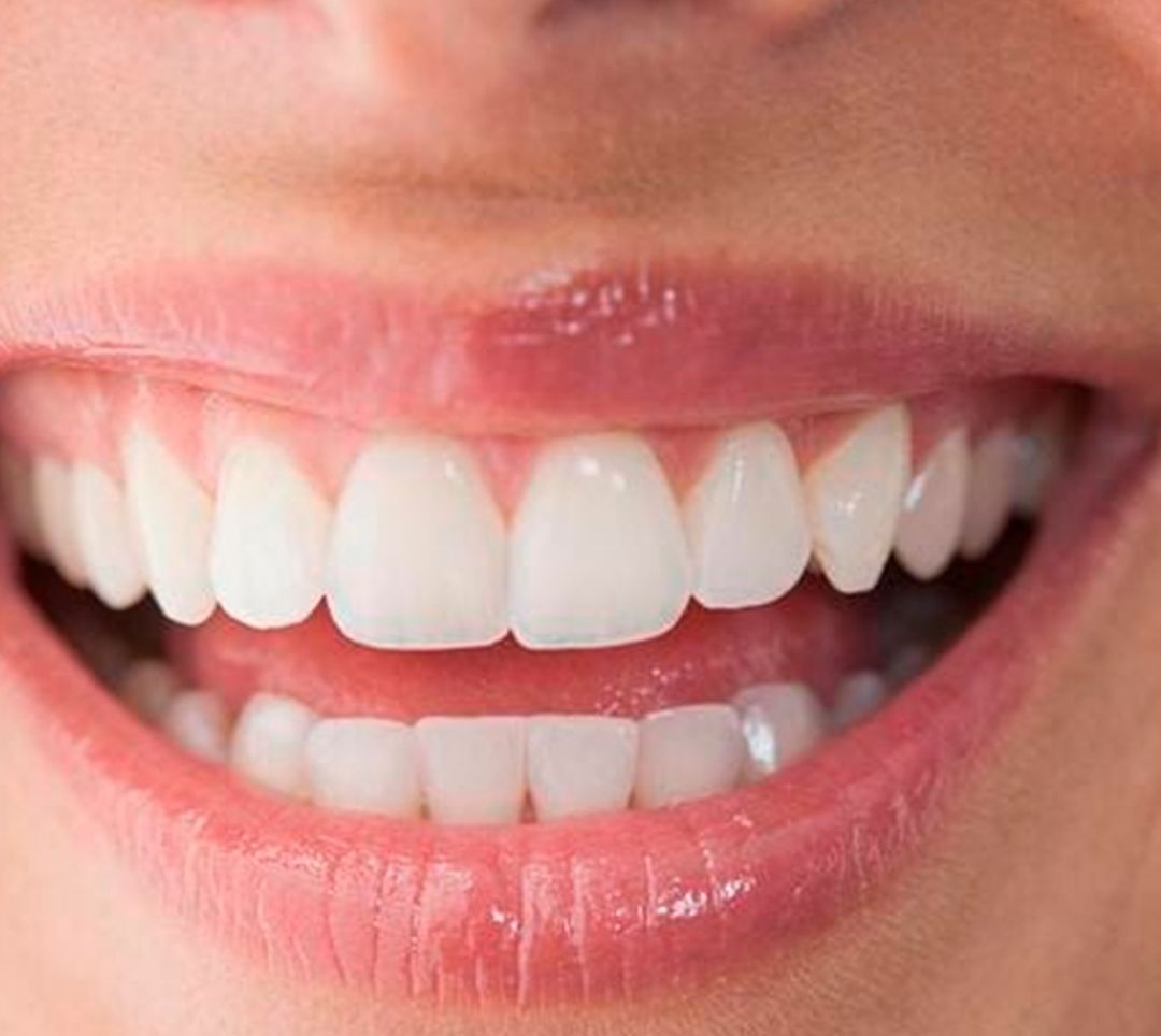 Con el solo acto de gesticular una sonrisa se mueven 400 músculos de la cara y se queman calorías, 20 segundos de risa equivale a 3 minutos de ejercicio.