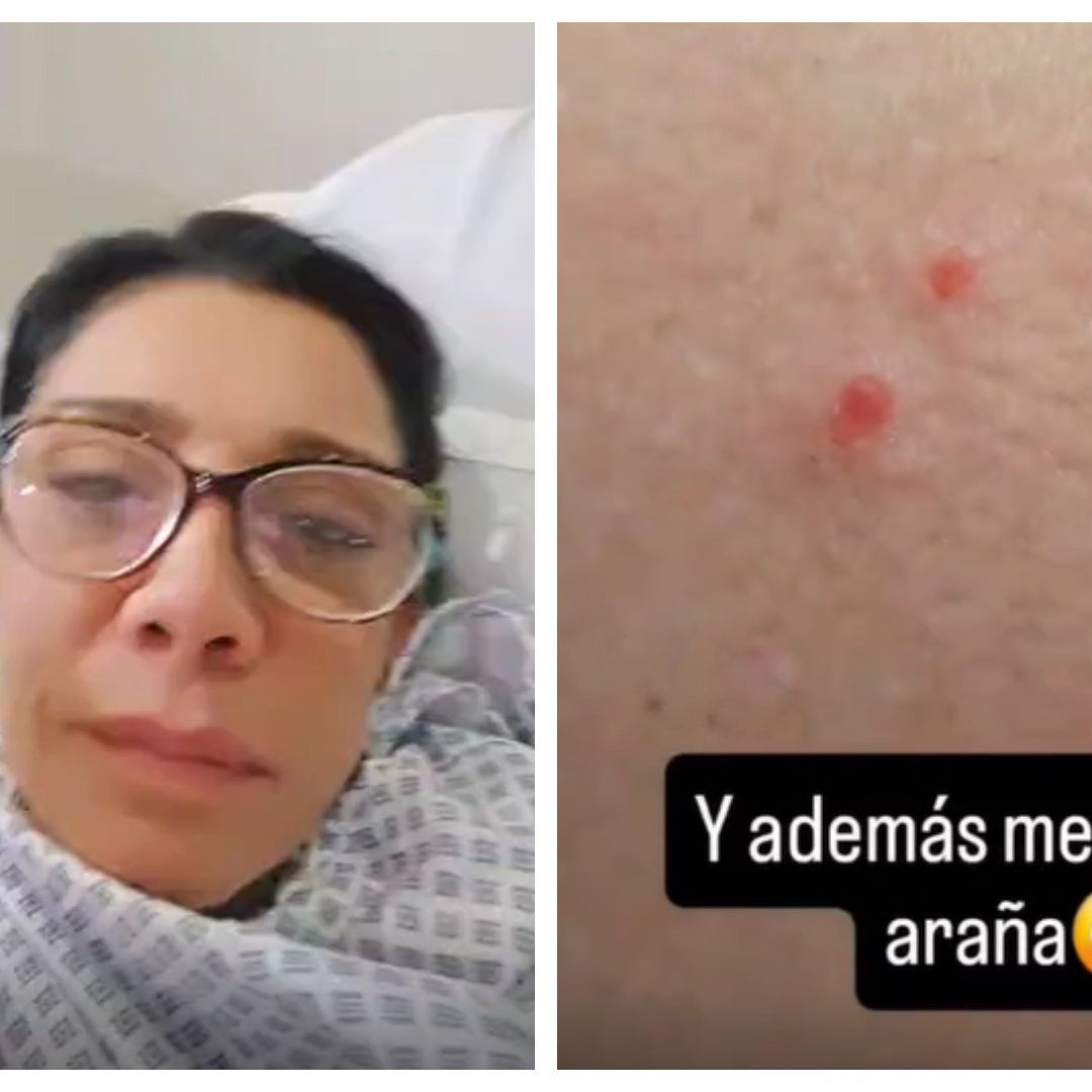 Klitbo describió que los músculos comenzaron a "brincarle" en la zona donde recibió la mordedura.
