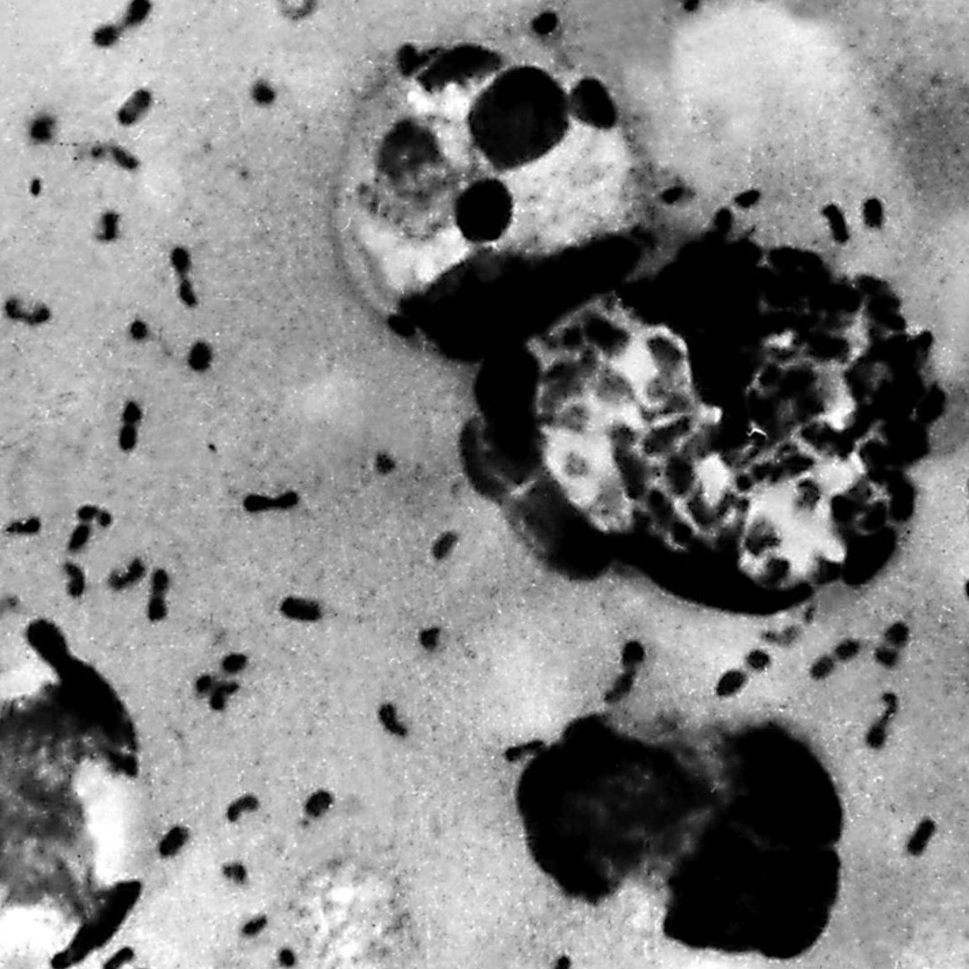 Imagen de la bacteria de la peste bubónica extraída de un paciente