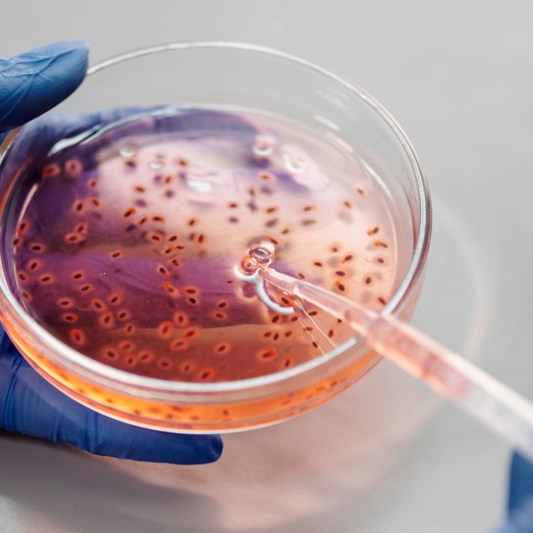 Bacteria Burkholderia Mata a 4 en BCS: ¿Cómo se Transmite y Cuáles son los Síntomas?