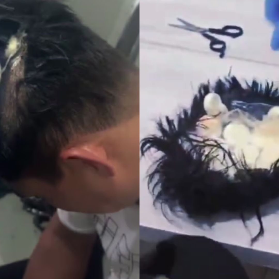 Detienen a hombre que ocultaba droga en una peluca. Foto: X @PoliciaColombia