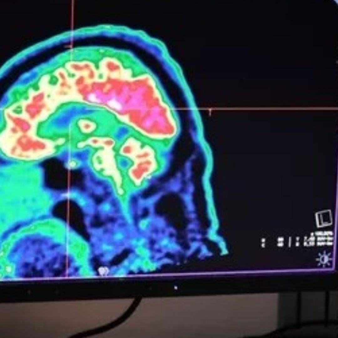 Un niño de 13 años desafía todos los pronósticos de sobrevivir a cáncer cerebral