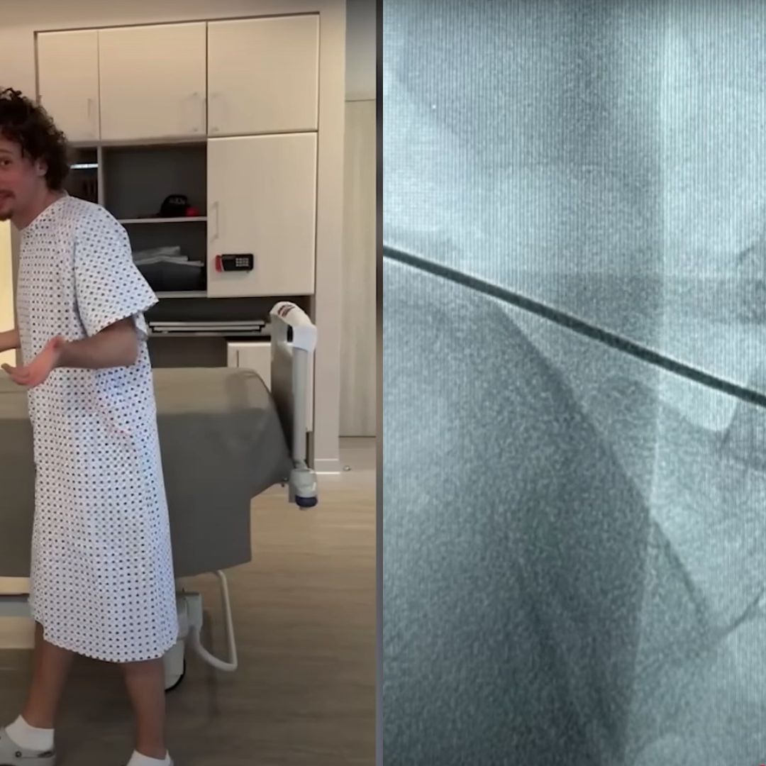 Operan a "Luisito" Comunica de hernias discales.