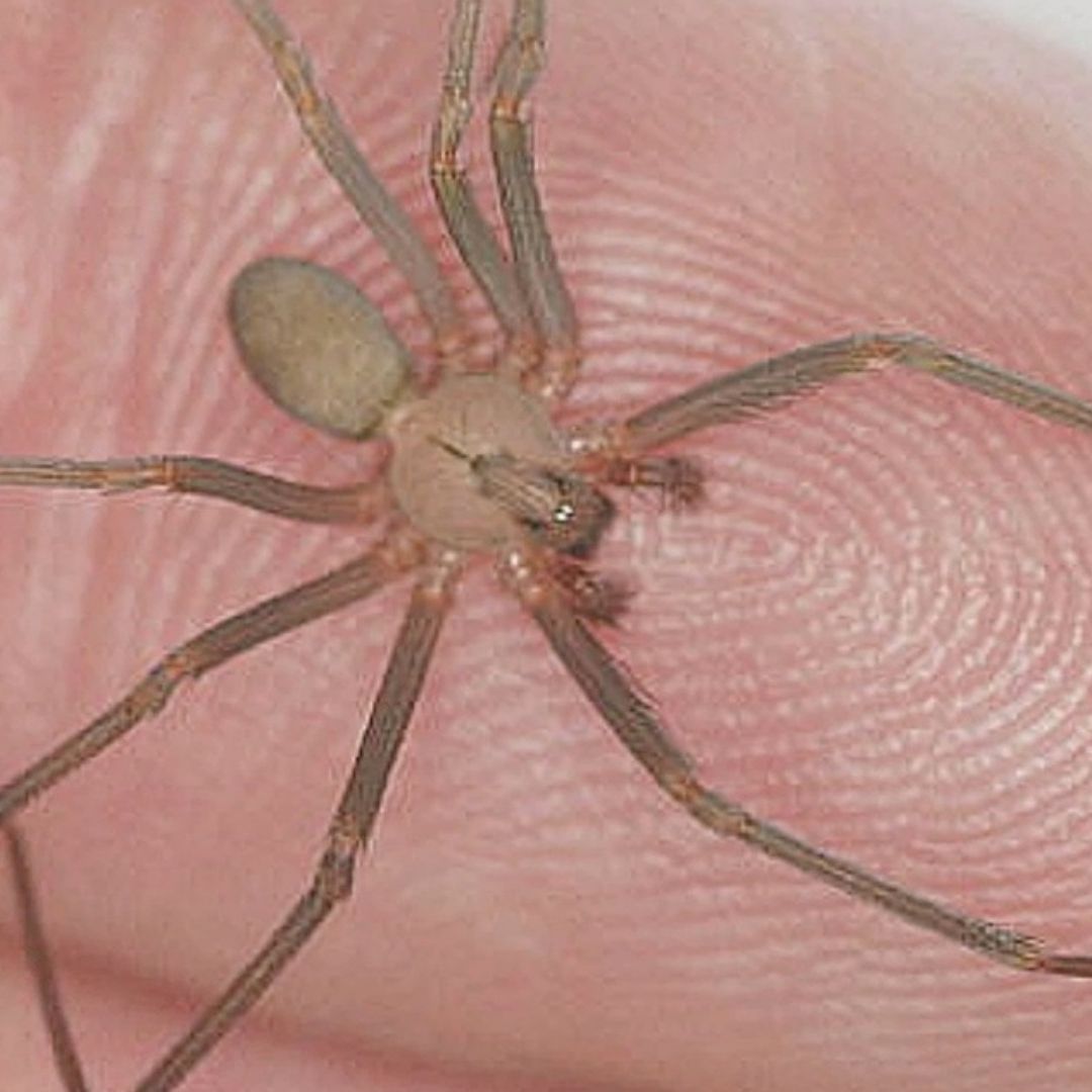 Síntomas por mordedura de araña violinista