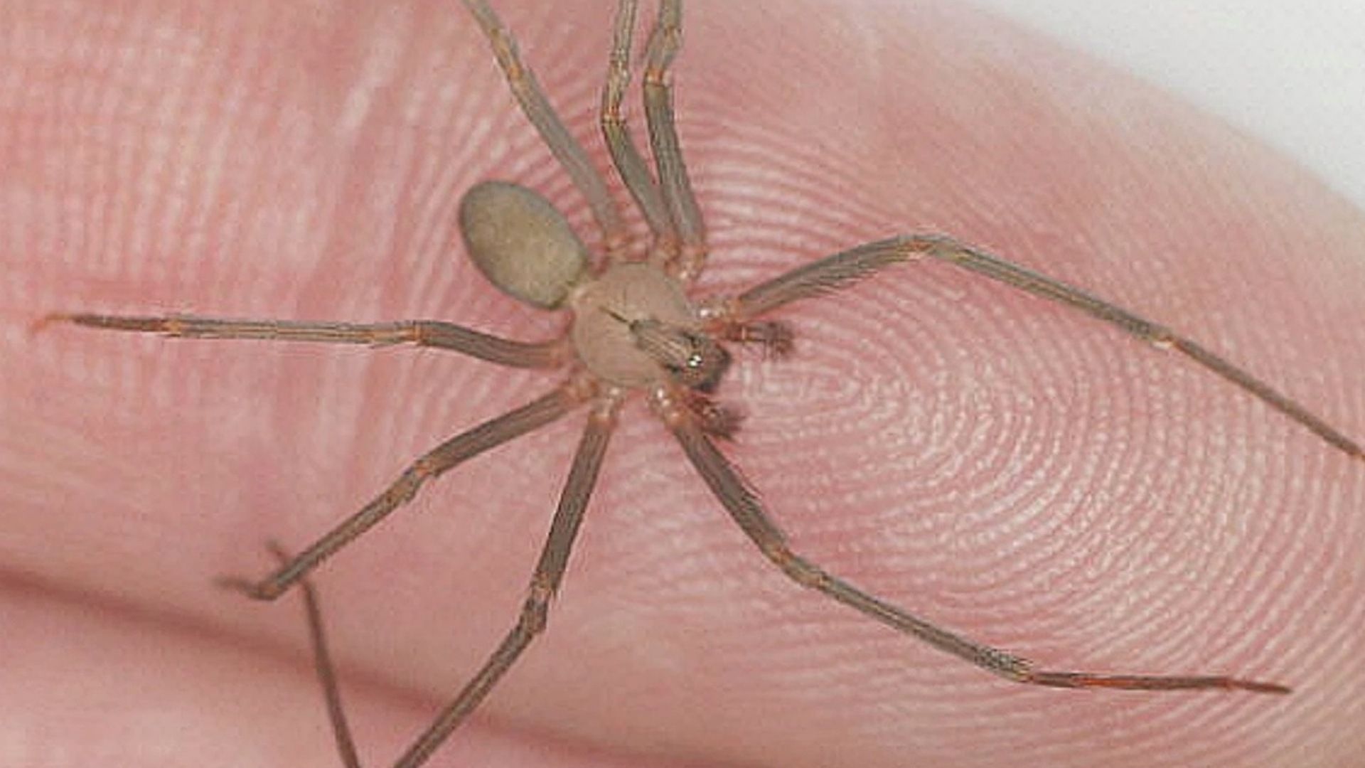 Síntomas por mordedura de araña violinista