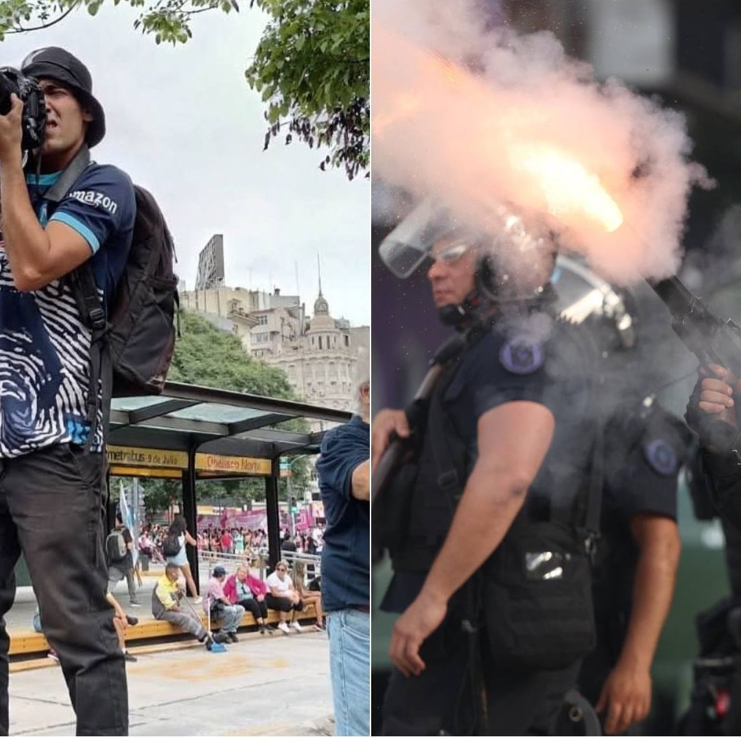 Fotógrafo Pablo Grillo se Encuentra Grave tras Recibir Disparo de la Policía Argentina