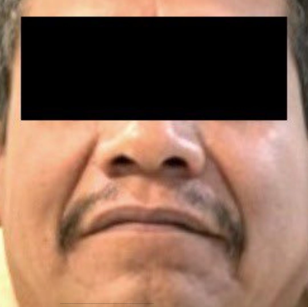 Proxeneta Poblano Extraditado a Estados Unidos por Delito de Tráfico y Explotación Sexual