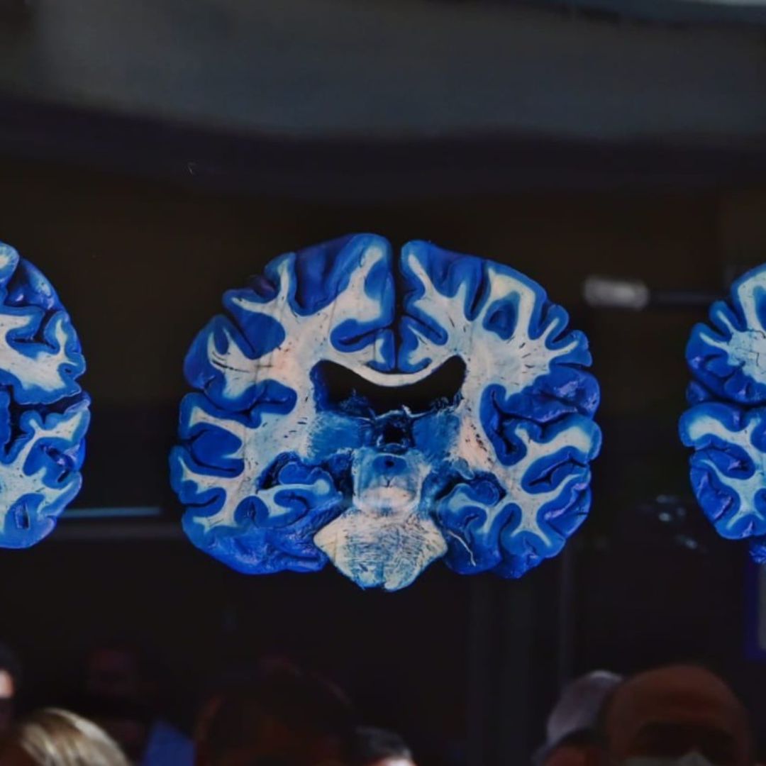 Cerebro Azul: Arte y Ciencia se Combinan en la Imagen Más Completa del Cerebro Humano