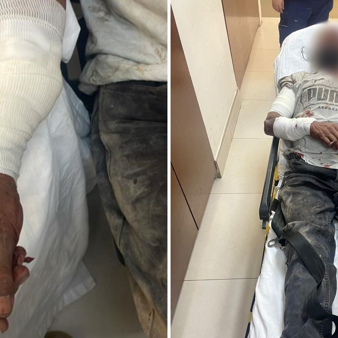 Perros Atacan a Adulto Mayor Cuando Caminaba Hacia su Casa en Mexicali