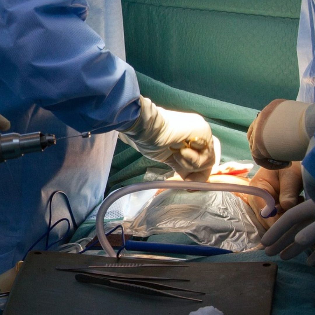 Mujer Muere Durante Liposucción; Estudiante de Medicina la Operó