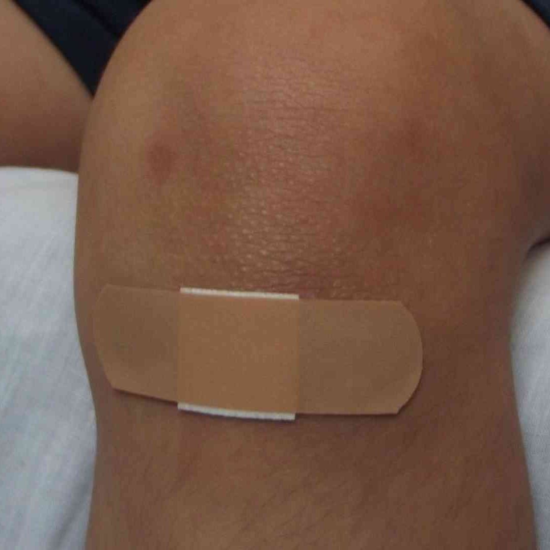 El 17 de abril es el Día Mundial de la Hemofilia.