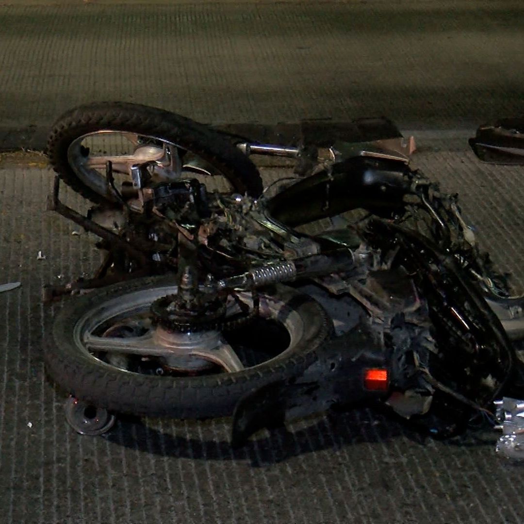 Motociclista pierde parte de la pierna a causa de un choque