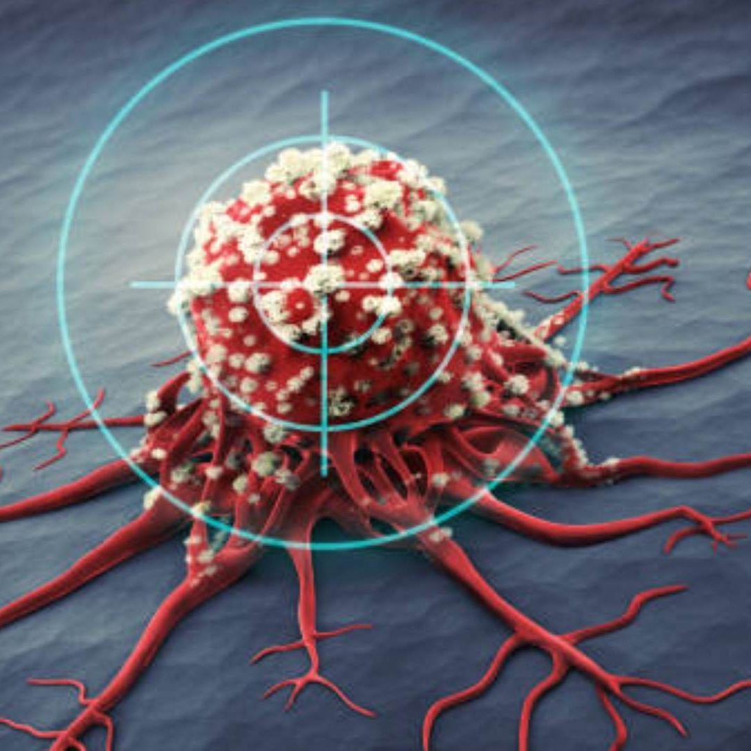 Leucemia Mieloide Aguda: ¿Por Qué Este Tipo de Cáncer Ataca a Más Jóvenes en México?