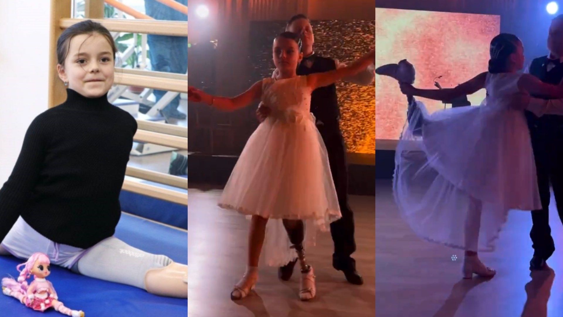 Sasha Pascal, de 7 años de edad perdió una pierna debido a un ataque con misiles rusos