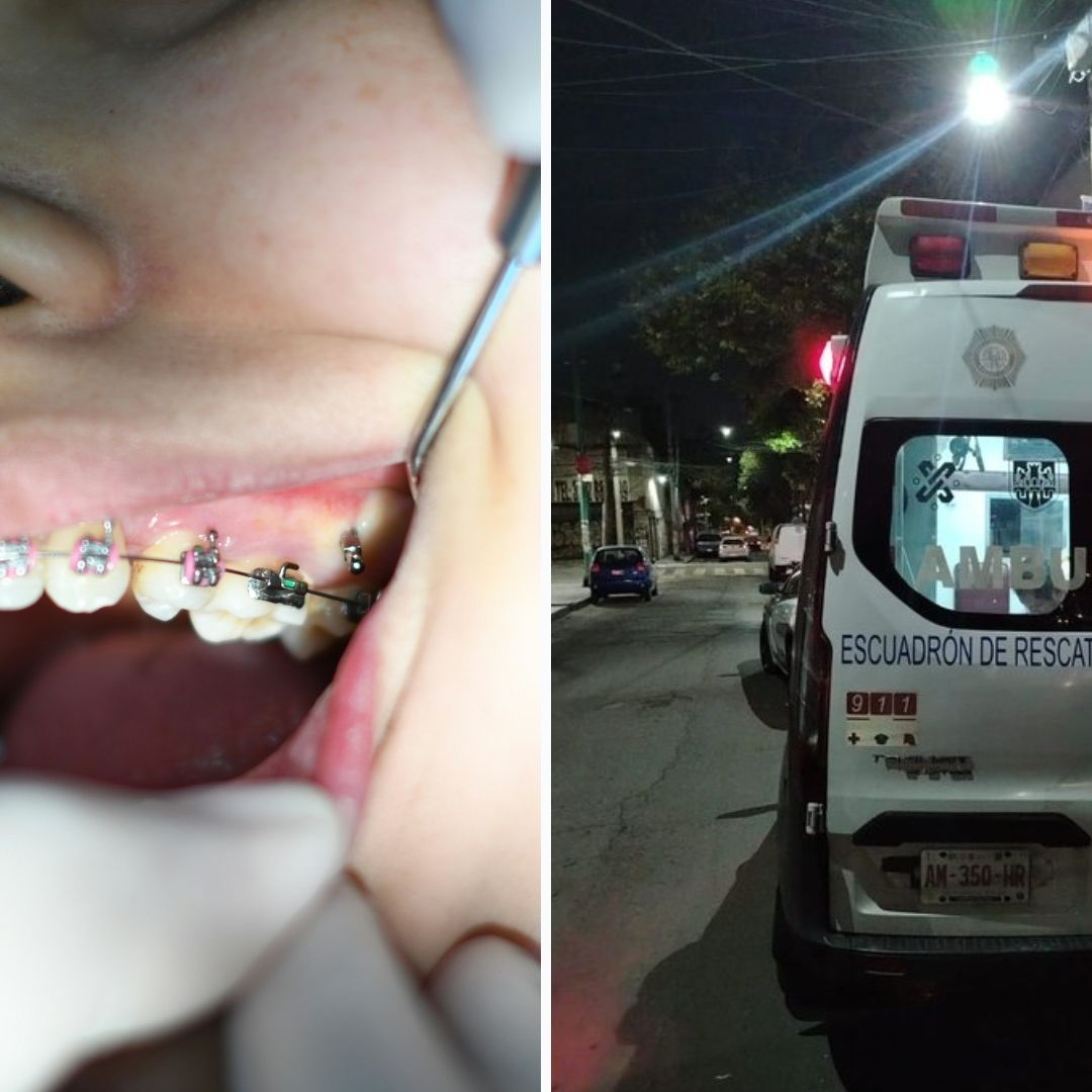 Joven le Corta los Genitales a su Novio con sus Brackets en CDMX; Así Pasó