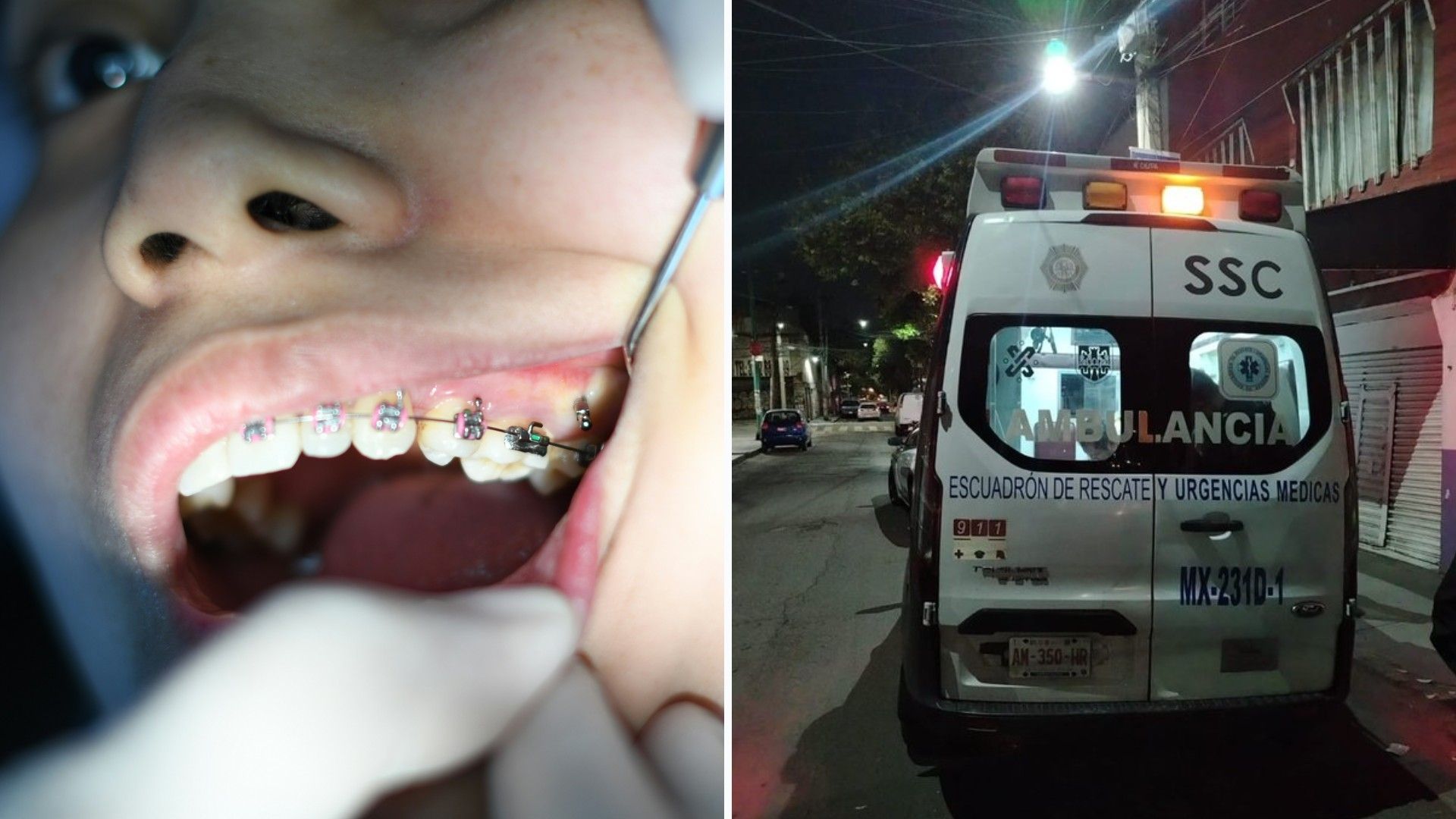 Joven le Corta los Genitales a su Novio con sus Brackets en CDMX; Así Pasó