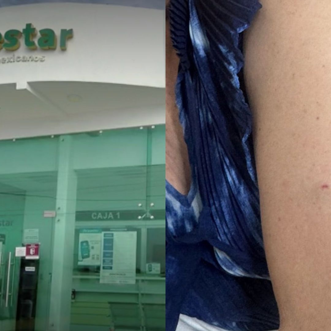 Mujer de la tercera edad recibió pinchazo mientras hacia fila para cobrar su Pensión del Bienestar