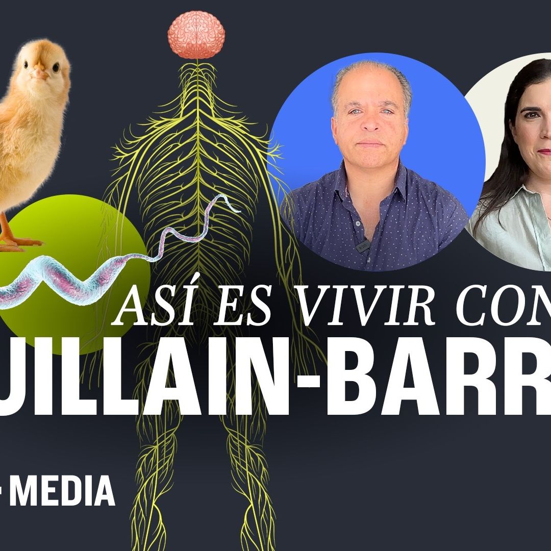 El Síndrome de Guillain Barré es una enfermedad autoinmune que afecta los nervios periféricos.