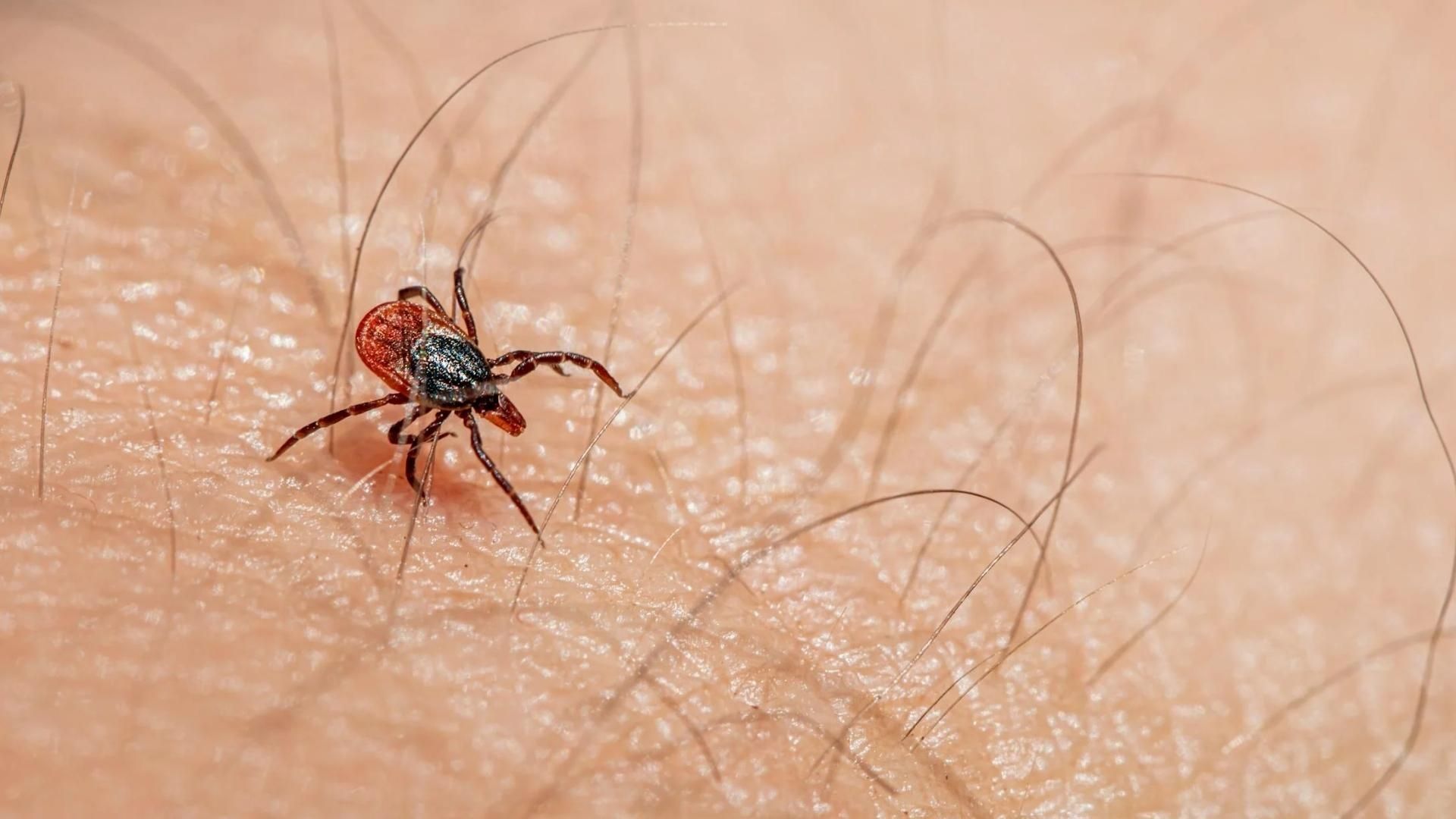 Confirman 27 casos de rickettsiosis en Chihuahua; van 10 defunciones | Foto: Pexels