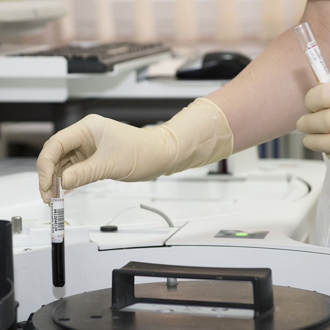 Mexicano con Gripe Aviar H5N2 Murió Enfermedades Crónicas, Secretaría Salud México
