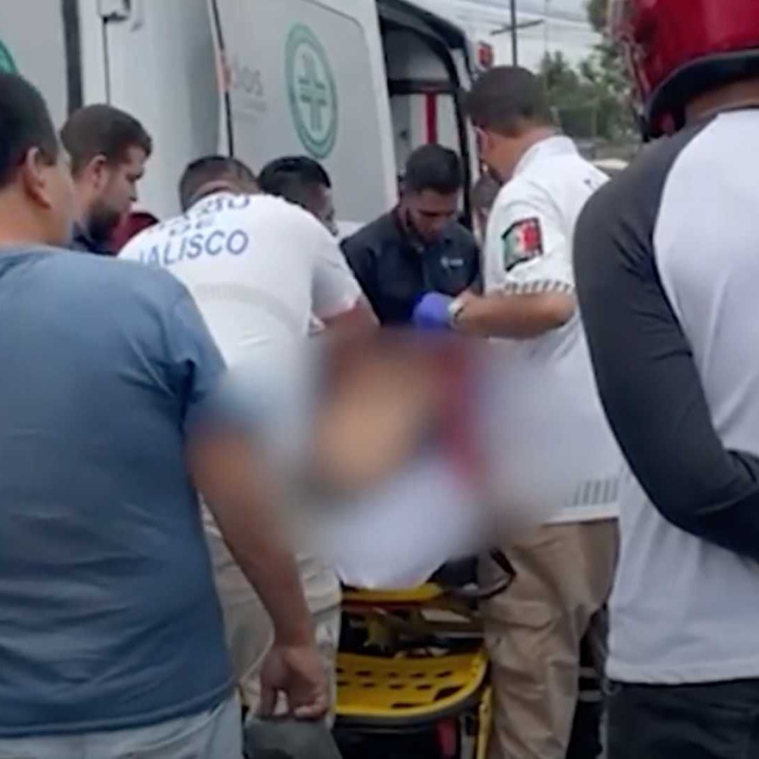 El hombre de la tercera edad resultó con posible fractura en ambas piernas