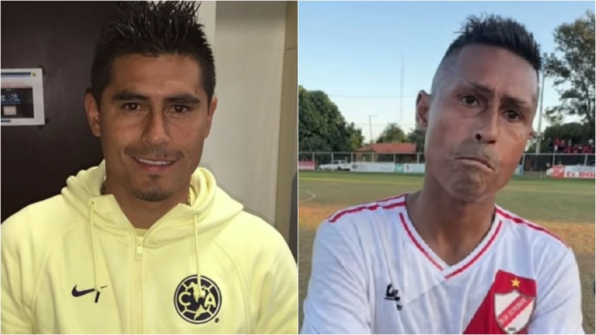 Osvaldo Martínez, exfutbolista del América, sufre cambios notorios en el rostro debido a la enfermedad que padece.