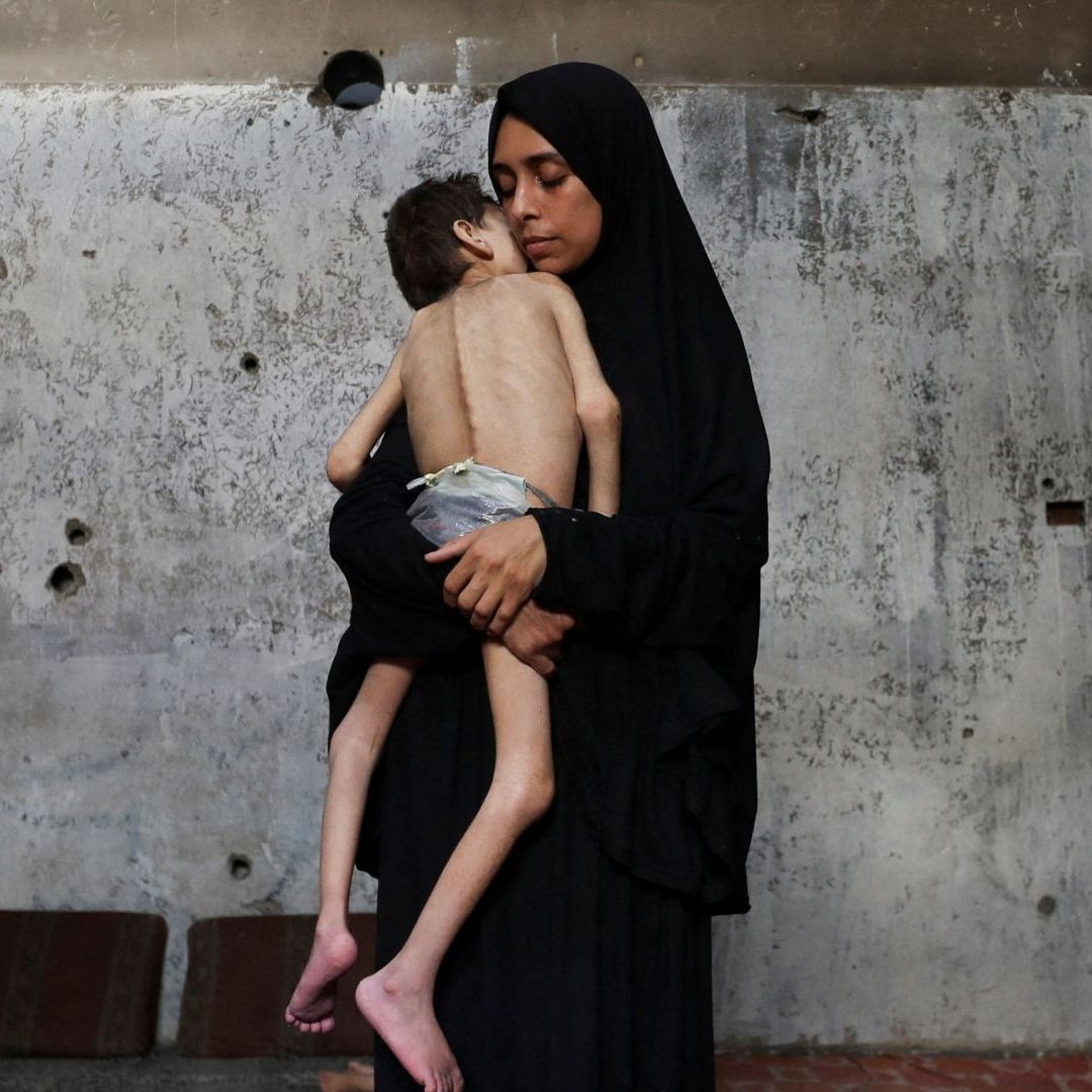 “Población Hambrienta de Gaza, No Está ni Muerta ni Viva, son Cadáveres Andantes”. ONU