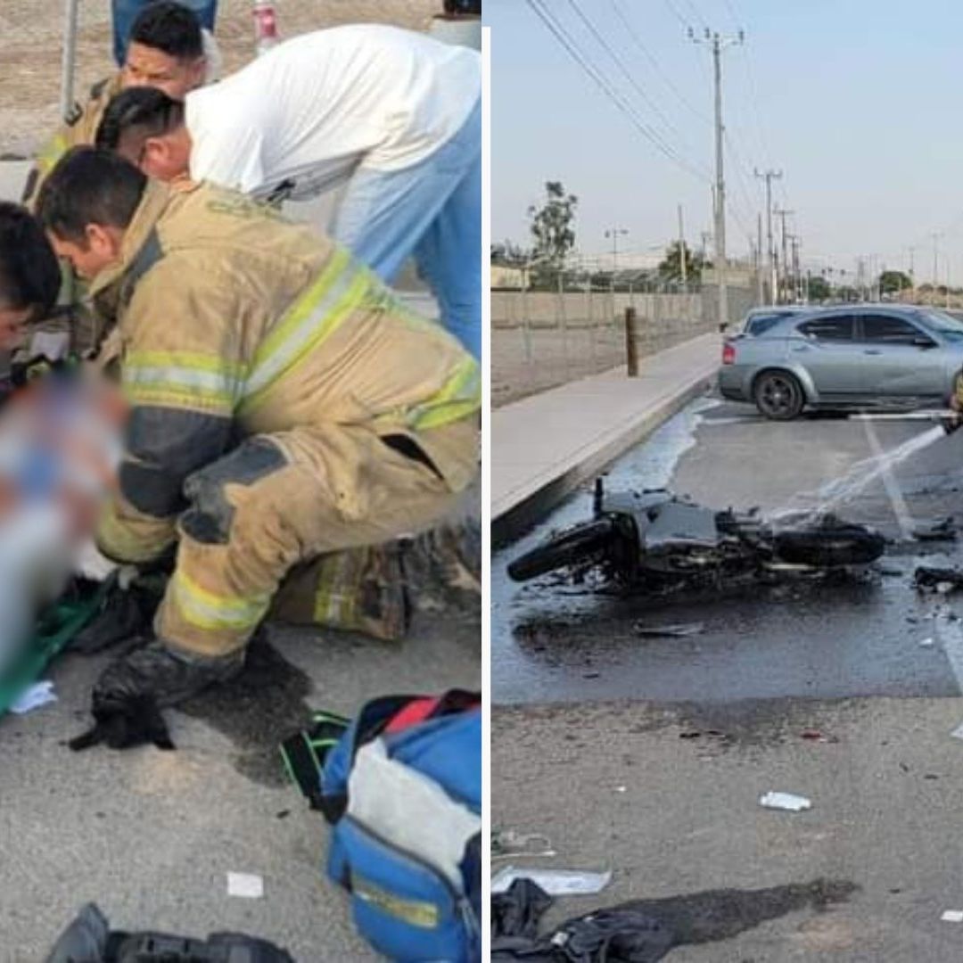 Joven Motociclista Sufre Quemaduras en la Mitad de su Cuerpo tras Accidente