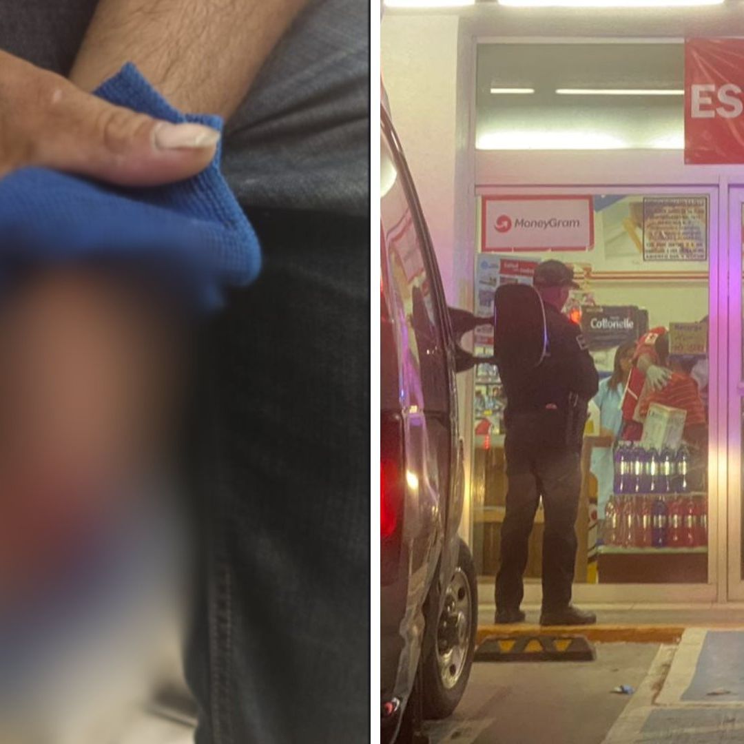 Tras Resistirse a Asalto, Ladrón Le Suelta Fuerte Mordida a su Víctima en Mexicali