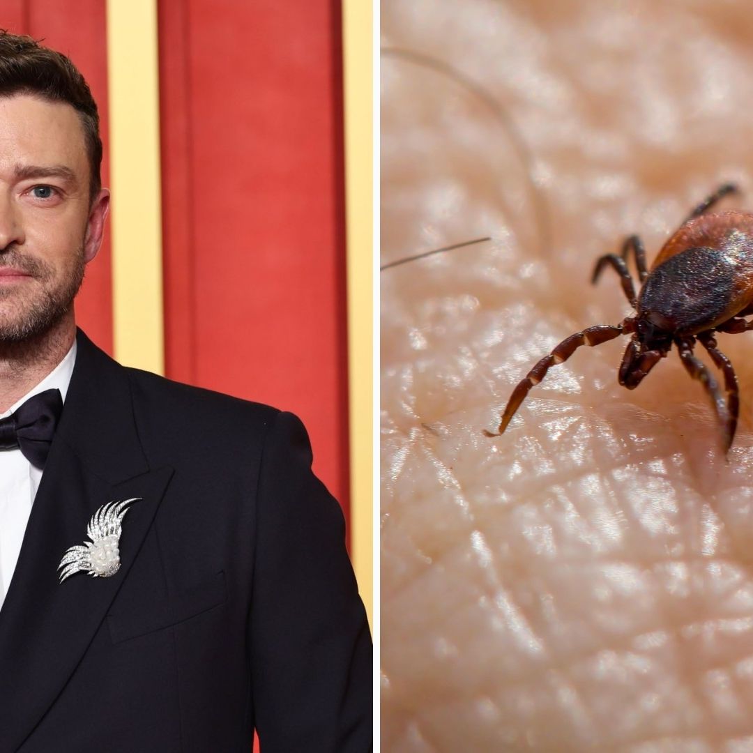 Enfermedad de Lyme: ¿Qué es, Cuáles son los Síntomas y la Cura? Esto Padece Justin Timberlake
