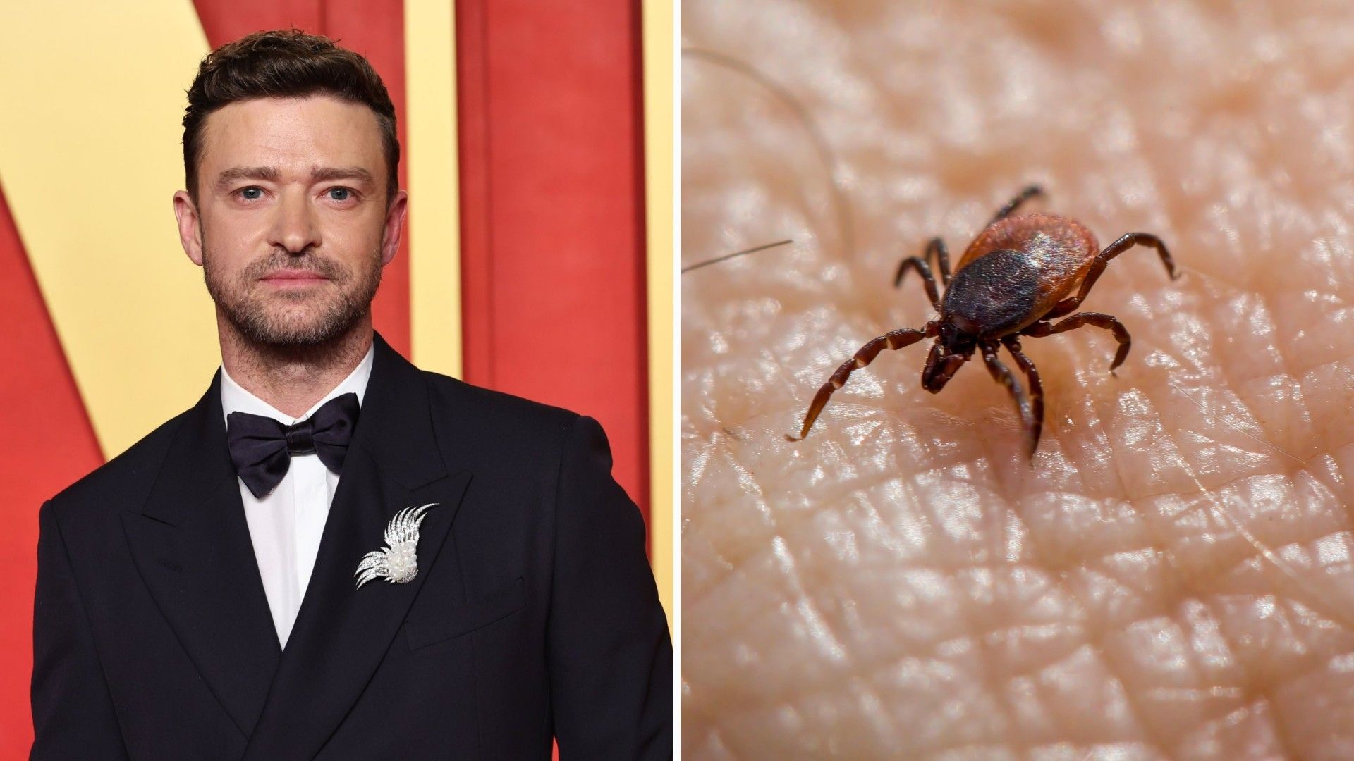 Enfermedad de Lyme: ¿Qué es, Cuáles son los Síntomas y la Cura? Esto Padece Justin Timberlake