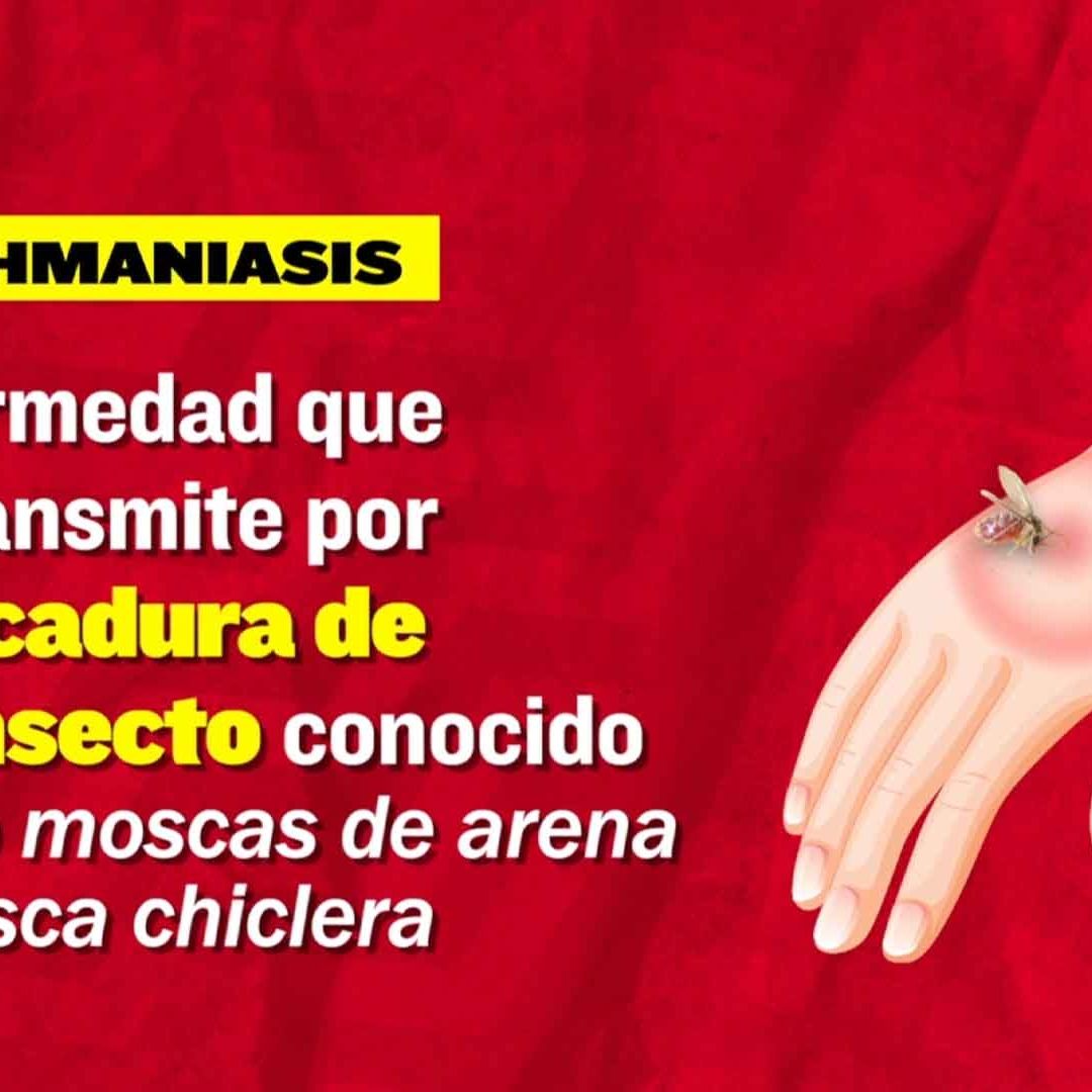Detectan Casos de Leishmaniasis en Matamoros, Tamaulipas