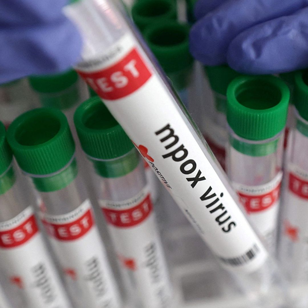 ¿Cuántos Casos y Muertes ha Ocasionado el Brote de Mpox en 2024? Contagios Siguen en Aumento