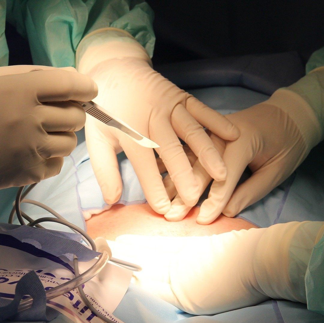 Negligencia en Cirugías Estéticas Acaba con el Sueño de un Cuerpo Perfecto