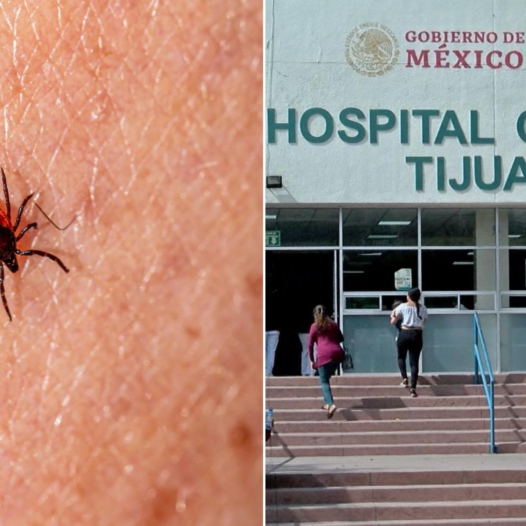 Confirman Muerte de Joven Evelín García por Complicaciones de Rickettsia