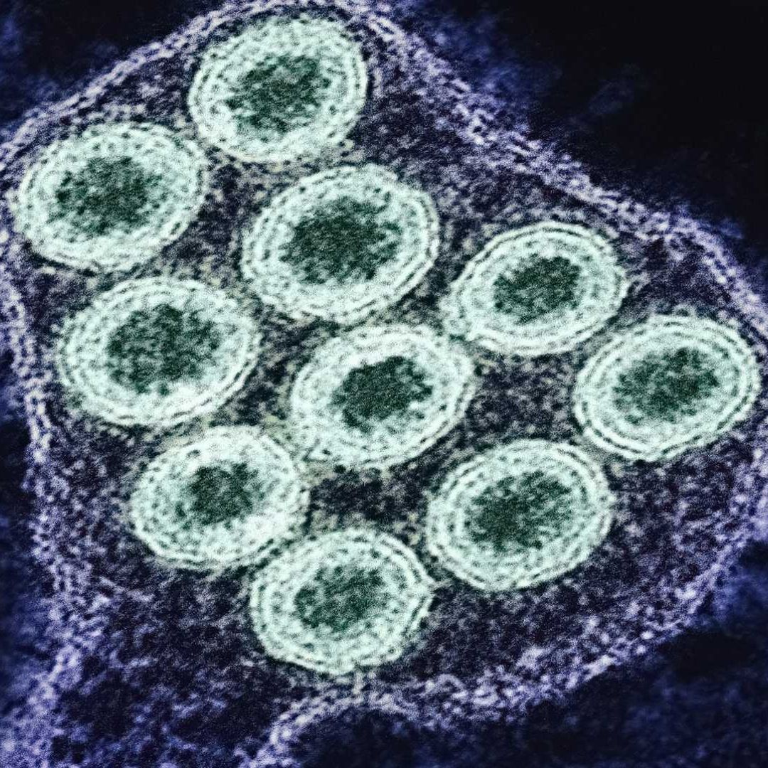 Virus de la rabia bajo el microscopio