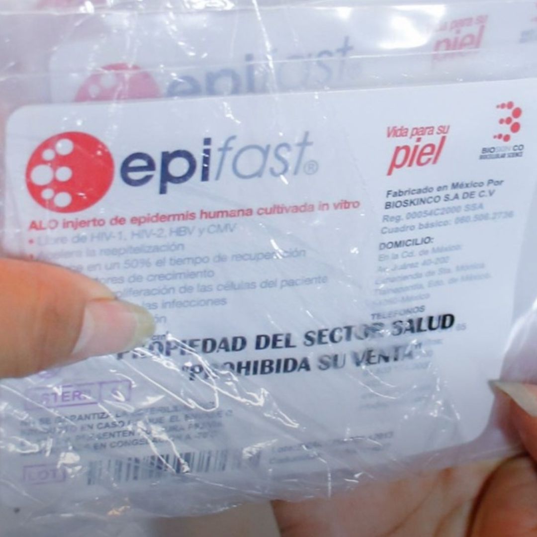 Explosión en Iztapalapa: Ayudan a Víctimas con Injerto de Piel Cultivada en Laboratorio