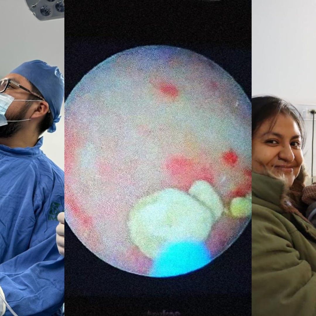 Médicos del IMSS Salvan a Bebé de 7 Meses Tras Retirarle Piedras en los Riñones