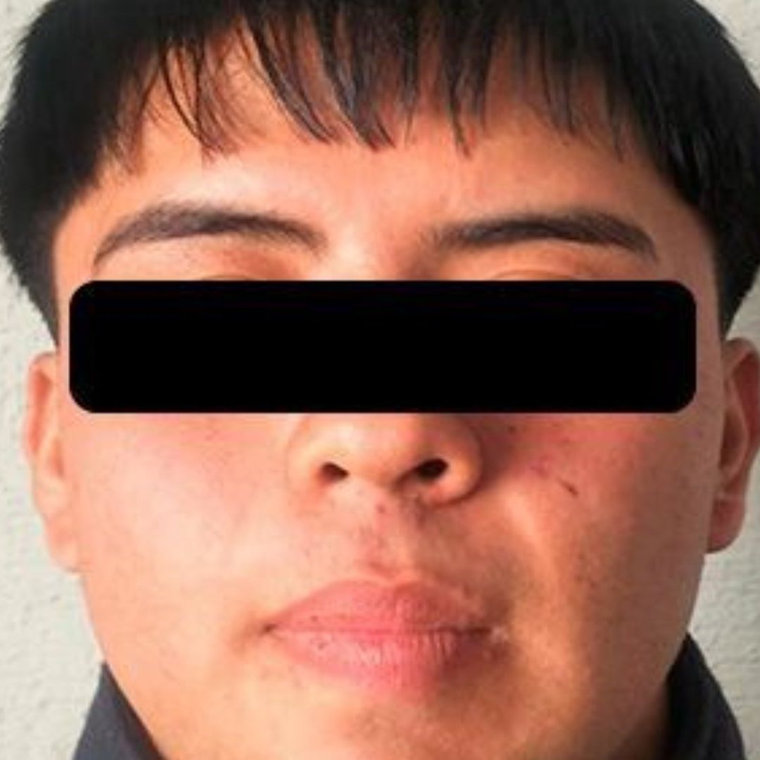 Hugo “N” fue detenido en la colonia Centro del municipio de Tlalnepantla y trasladado al Centro de Justicia de Texcoco