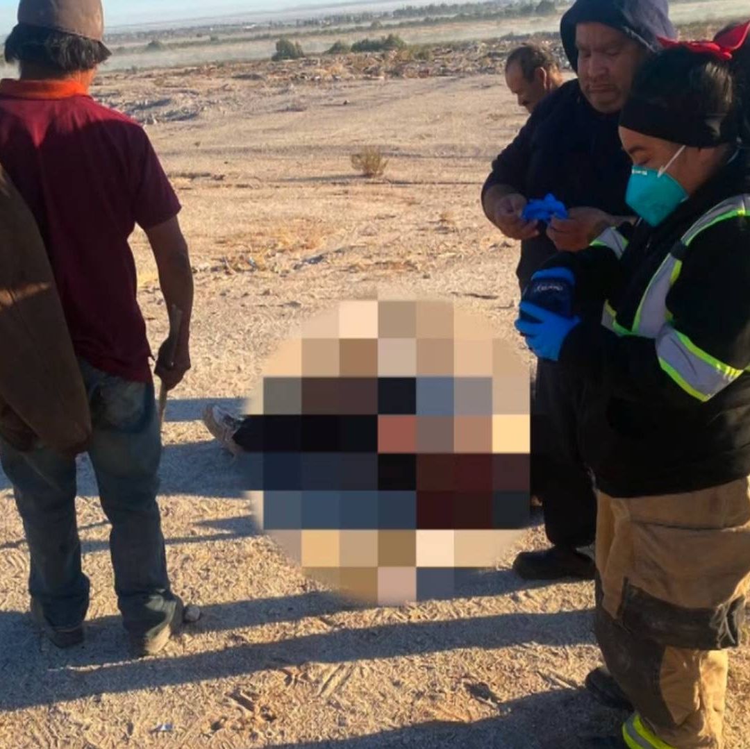 Junto a Relleno Sanitario, 15 Perros Atacan y Dejan Herido a Hombre en Mexicali
