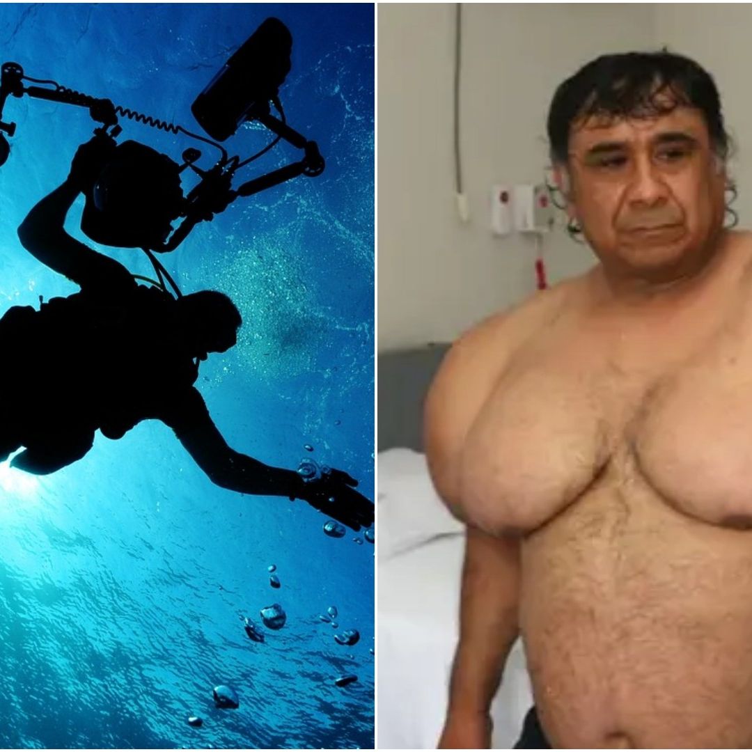 Alejandro Ramos vive inflado de la parte superior del cuerpo.