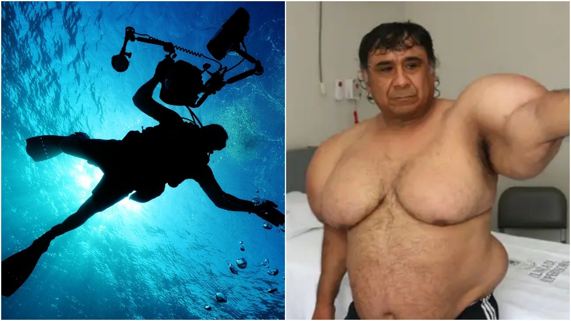 Alejandro Ramos vive inflado de la parte superior del cuerpo.
